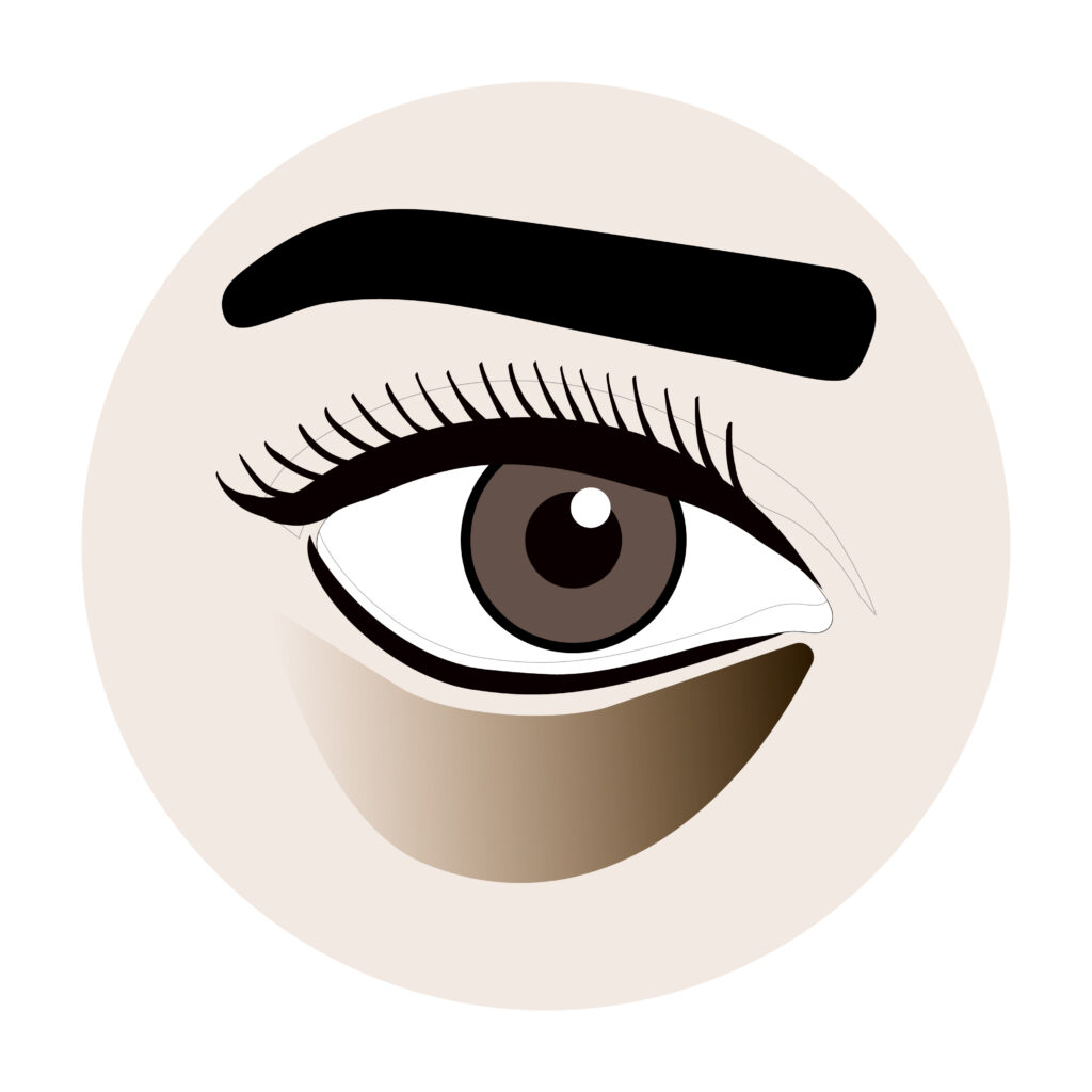This Is How To Get Rid Of Under-Eye Dark Circles