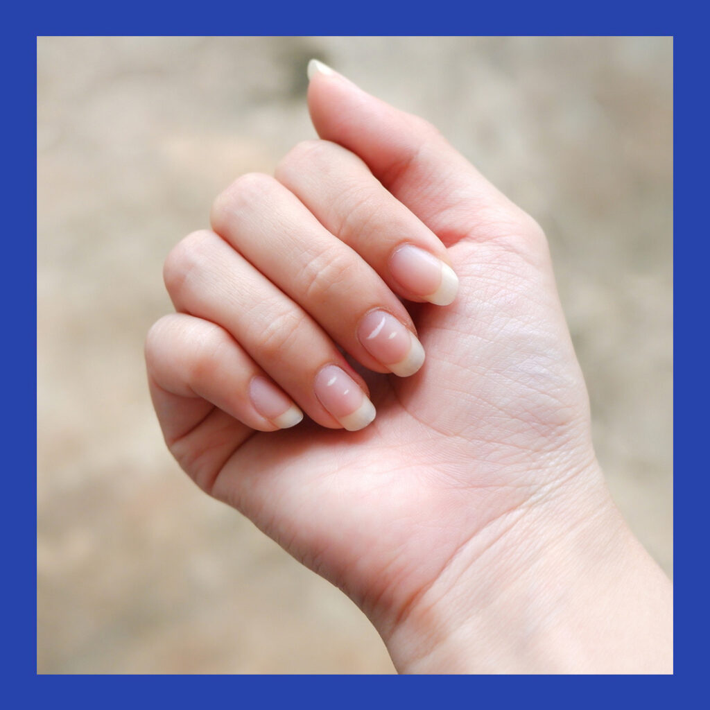 Here’s What Certain Changes In Your Nails Can Reveal About Your Health, According To Dermatologists